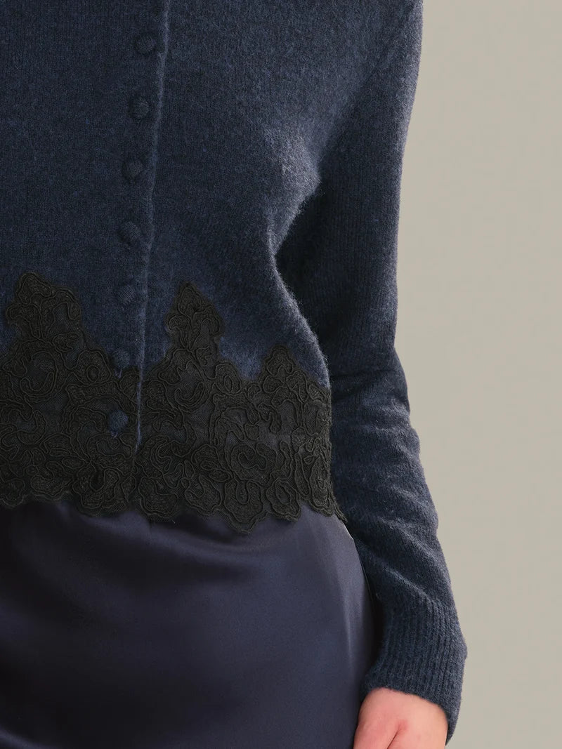 Harrington Lace Trim Cardigan